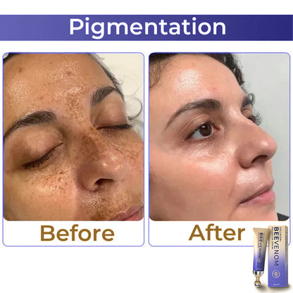 ✨ flysmus™ Collagen+ Bee Venom Roller Eye Cream