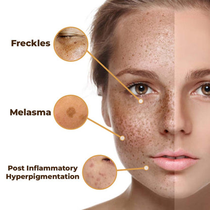 flysmus™ PeptideLuxe Melanin Vanish Serum 🌿 Natural Ingredients 🇺🇸 AAD Approved
